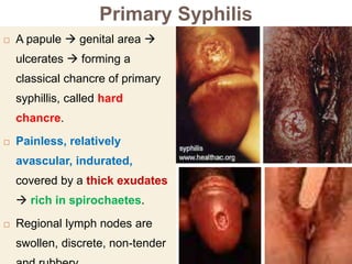 Primary Syphilis
 A papule  genital area 
ulcerates  forming a
classical chancre of primary
syphillis, called hard
chancre.
 Painless, relatively
avascular, indurated,
covered by a thick exudates
 rich in spirochaetes.
 Regional lymph nodes are
swollen, discrete, non-tender
 