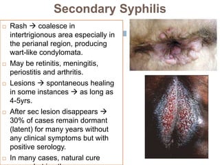 Secondary Syphilis
 Rash  coalesce in
intertrigionous area especially in
the perianal region, producing
wart-like condylomata.
 May be retinitis, meningitis,
periostitis and arthritis.
 Lesions  spontaneous healing
in some instances  as long as
4-5yrs.
 After sec lesion disappears 
30% of cases remain dormant
(latent) for many years without
any clinical symptoms but with
positive serology.
 In many cases, natural cure
 