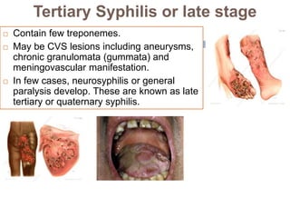 Tertiary Syphilis or late stage
 Contain few treponemes.
 May be CVS lesions including aneurysms,
chronic granulomata (gummata) and
meningovascular manifestation.
 In few cases, neurosyphilis or general
paralysis develop. These are known as late
tertiary or quaternary syphilis.
 