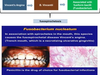 Vincent’s Angina B. Vincentii
Associated with
fusiform bacilli
(Fusobacterium
fusiforme)
fusospirochetosis
 