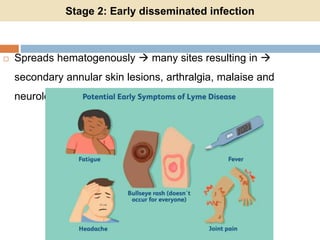 Stage 2: Early disseminated infection
 Spreads hematogenously  many sites resulting in 
secondary annular skin lesions, arthralgia, malaise and
neurological abnormalities
 