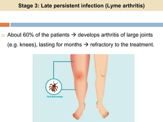 Stage 3: Late persistent infection (Lyme arthritis)
 About 60% of the patients  develops arthritis of large joints
(e.g. knees), lasting for months  refractory to the treatment.
 