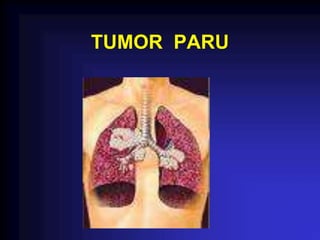 TUMOR PARU
 