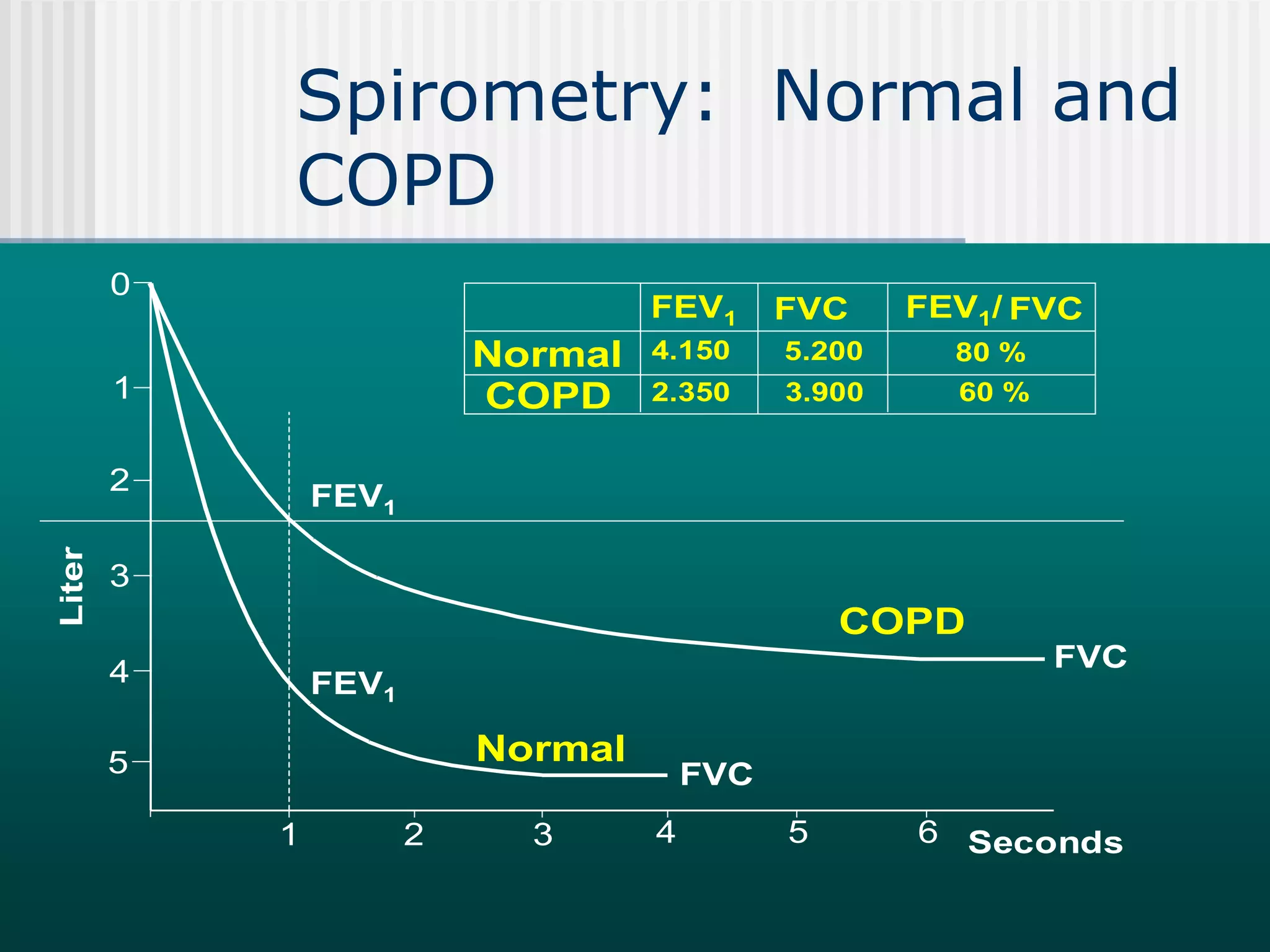 Spirometry: Normal and
COPD
0
5
1
4
2
3
Liter
1 65432
FVC
FVC
FEV1
FEV1
Normal
COPD
3.900
5.200
2.350
4.150 80 %
60 %
Normal
COPD
FVCFEV1 FVCFEV1/
Seconds
 