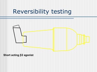 Reversibility testing
Short acting β2 agonist
 