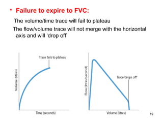 Failure to expire to FVC:   The volume/time trace will fail to plateau The flow/volume trace will not merge with the horizontal axis and will ‘drop off’ 