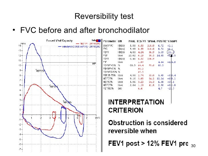 Spirometry