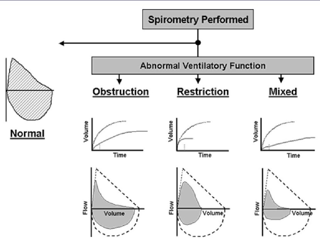 Spirometry