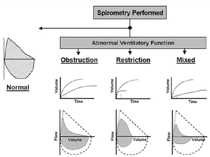 Spirometry