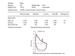 Interpreting Lung Function Tests: A Step-by Step Guide 1st ed.
 
