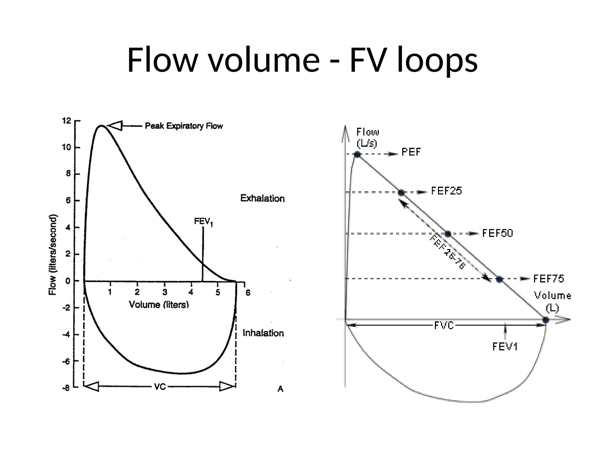 Flow volume - FV loops
 