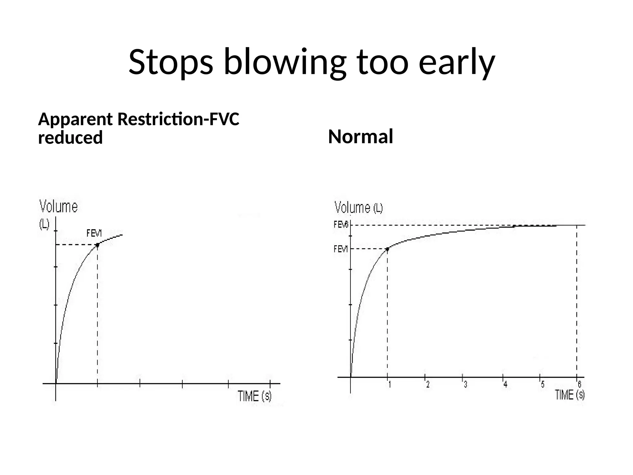 Stops blowing too early
Apparent Restriction-FVC
reduced Normal
 