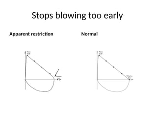 Stops blowing too early
Apparent restriction Normal
 