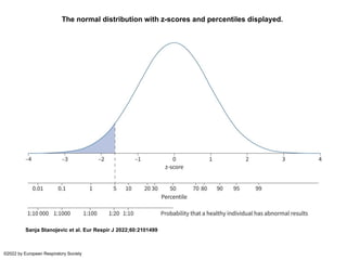 The normal distribution with z-scores and percentiles displayed.
Sanja Stanojevic et al. Eur Respir J 2022;60:2101499
©2022 by European Respiratory Society
 
