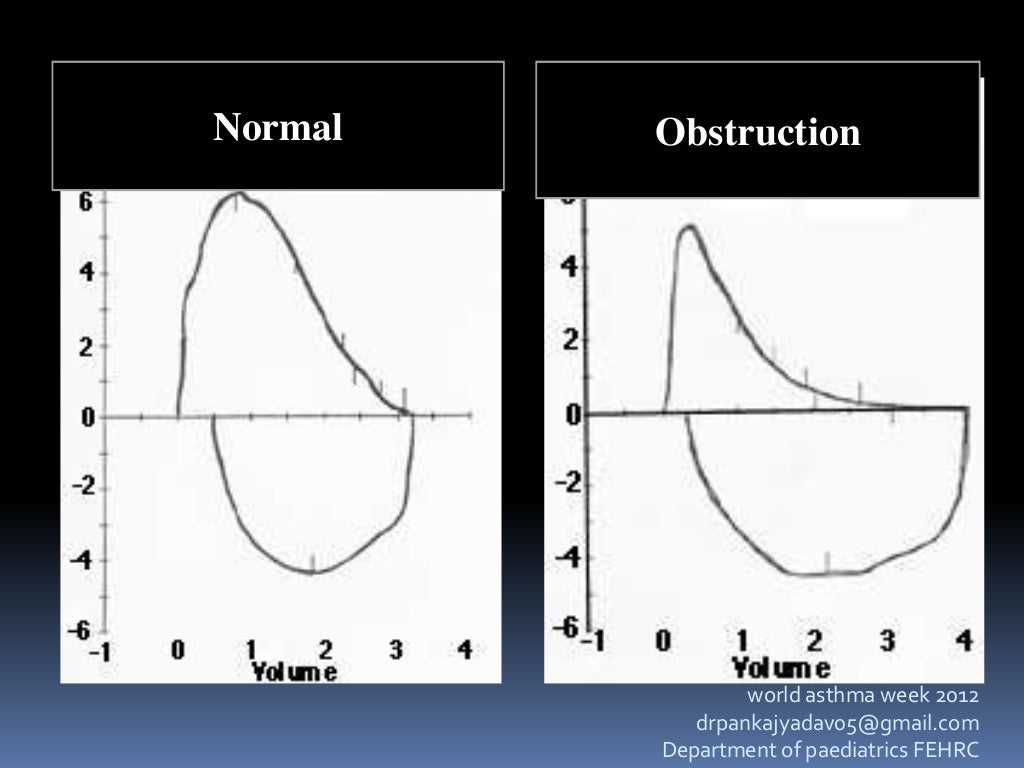 Spirometry and peak flow metry in bronchial asthma