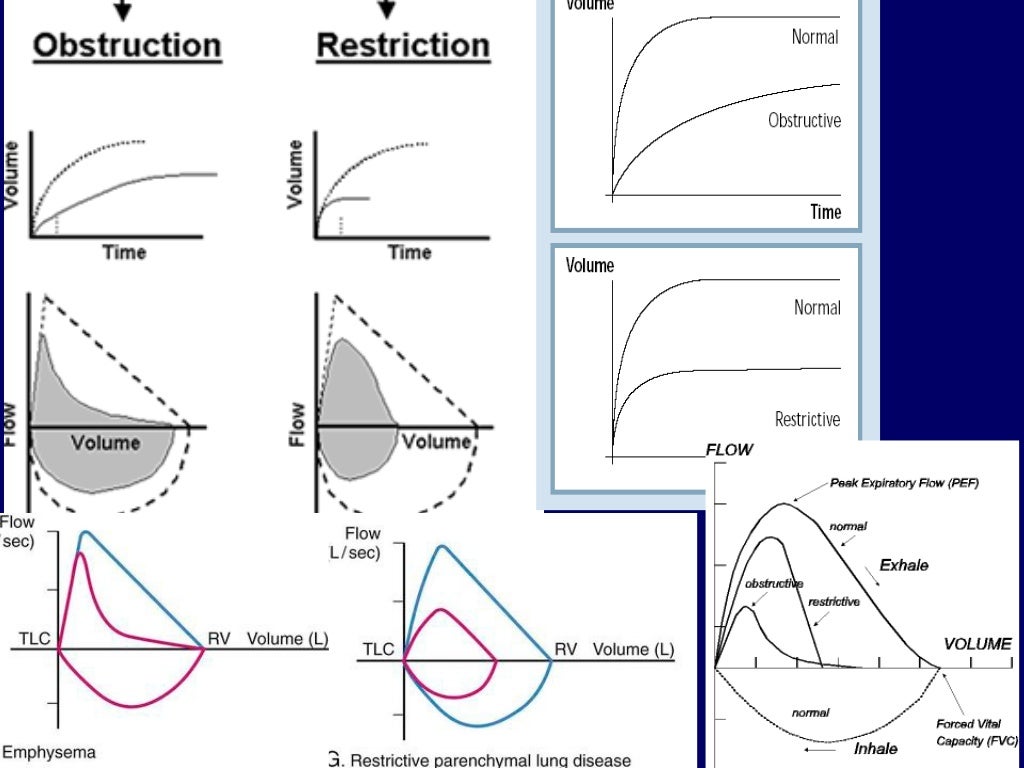 Spirometry in practice