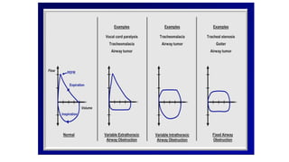 Spirometry ppt.pptx lung function test ppt | PPTX