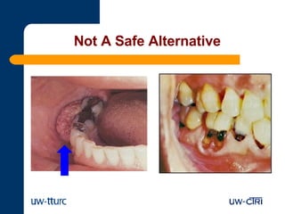 Spit Tobacco | PPT
