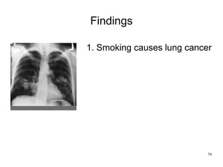70
Findings
1. Smoking causes lung cancer
 