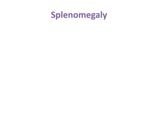 Splenomegaly
 