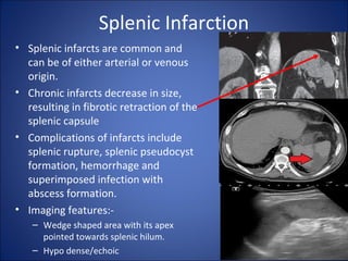 Spleen; Imaging Anatomy, Investigations and Pathology | PPT
