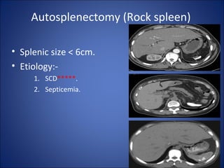 Spleen; Imaging Anatomy, Investigations and Pathology | PPT