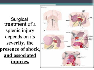 Splene Injury Spleen in surgery | PPT