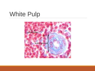 White Pulp
 