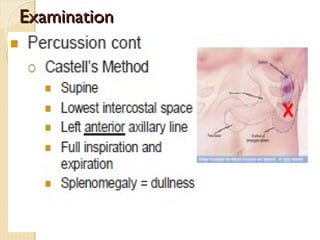 spleen-gross anatomy - physiology---.ppt