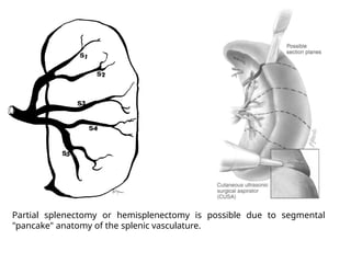Splenectomized Patient spleen presentation applied in health.pptx