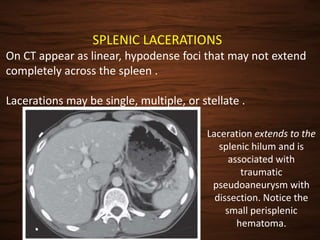 Spleen[1] | PPTX