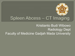 Kristianto Budi Wibowo
                             Radiology Dept
Faculty of Medicine Gadjah Mada University
 