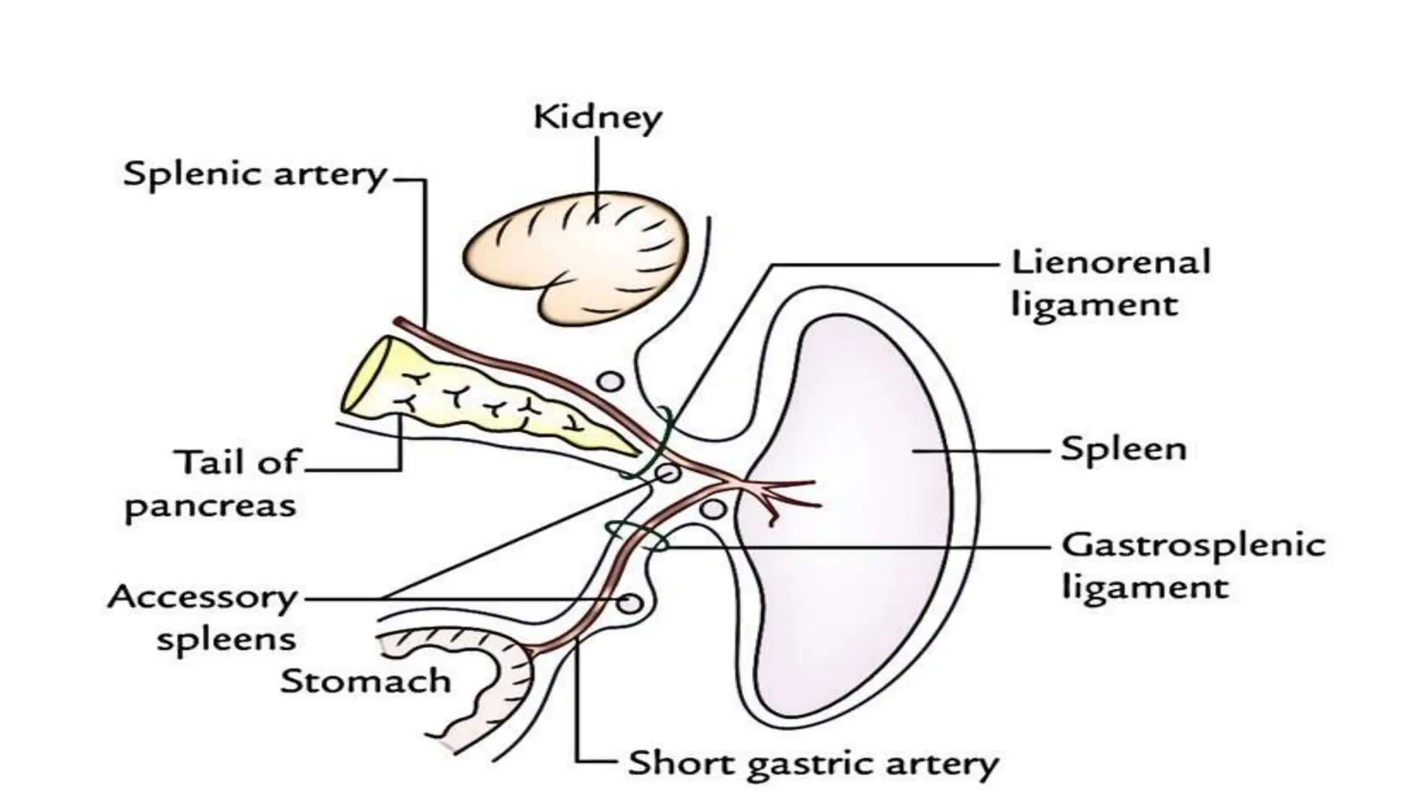 spleenectomy complication.pptxkk;lkjhjgfj | PPT