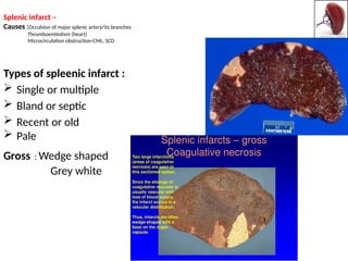 Spleen & Lymph Node Pathophysiology .pptx