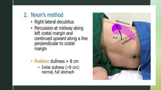 spleen medicine and it's Examination.pptx