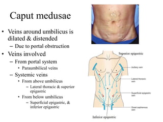 Caput Med Spleen & portal vein | PDF