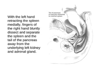 Splene Injury SPLENIC INJURY: A BRIEF SURGICAL MANAGEMENT | PPTX