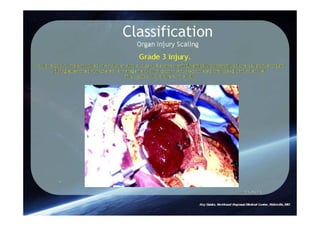 Spleen Trauma Classification