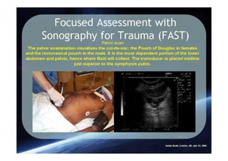 Spleen Trauma Classification