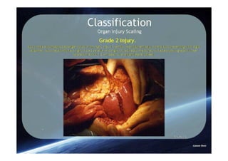 Spleen Trauma Classification
