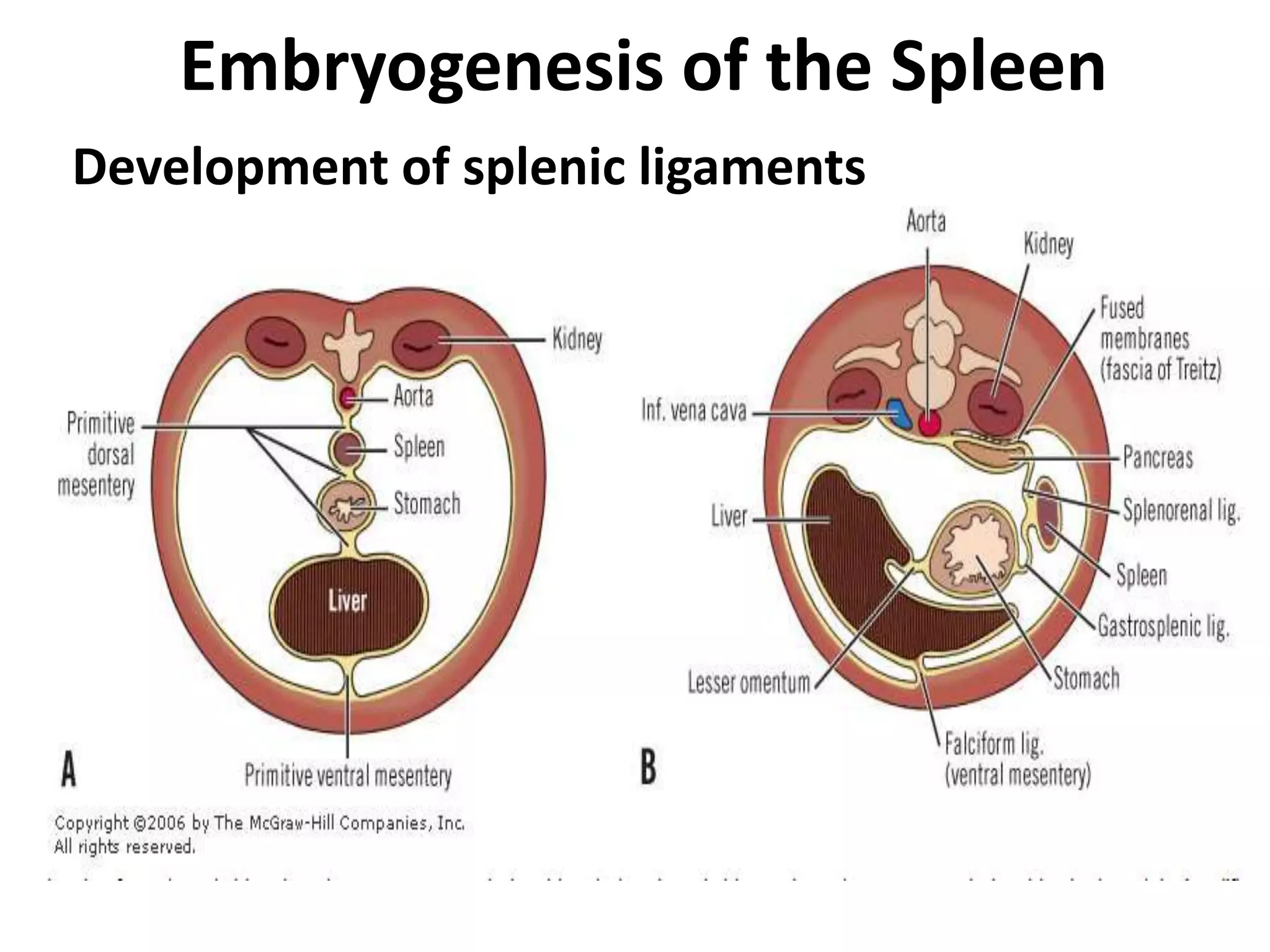 pre and post operative management of paediatric Splenectomy patients | PPTX