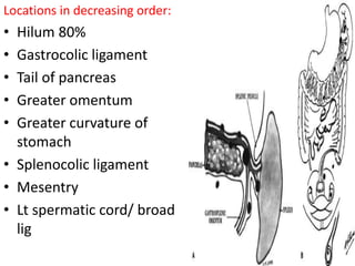 Locations in decreasing order:
• Hilum 80%
• Gastrocolic ligament
• Tail of pancreas
• Greater omentum
• Greater curvature of
stomach
• Splenocolic ligament
• Mesentry
• Lt spermatic cord/ broad
lig
 