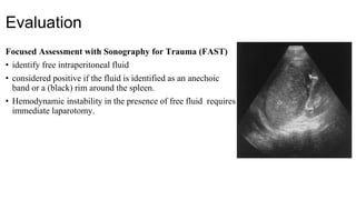 Evaluation
Focused Assessment with Sonography for Trauma (FAST)
• identify free intraperitoneal fluid
• considered positive if the fluid is identified as an anechoic
band or a (black) rim around the spleen.
• Hemodynamic instability in the presence of free fluid requires
immediate laparotomy.
 