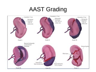 AAST Grading
 