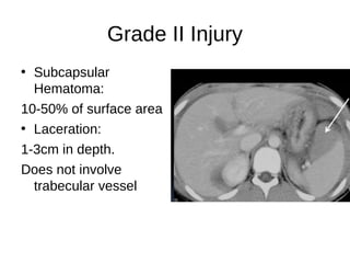 Grade II Injury
• Subcapsular
Hematoma:
10-50% of surface area
• Laceration:
1-3cm in depth.
Does not involve
trabecular vessel
 