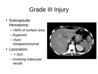 Grade III Injury
• Subcapsular
Hematoma:
– >50% of surface area
– Ruptured
– >5cm
Intraparenchymal
• Laceration:
– > 3cm
– Involving trabecular
vessel
 