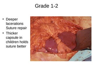 Grade 1-2
• Deeper
lacerations
Suture repair
• Thicker
capsule in
children holds
suture better
 