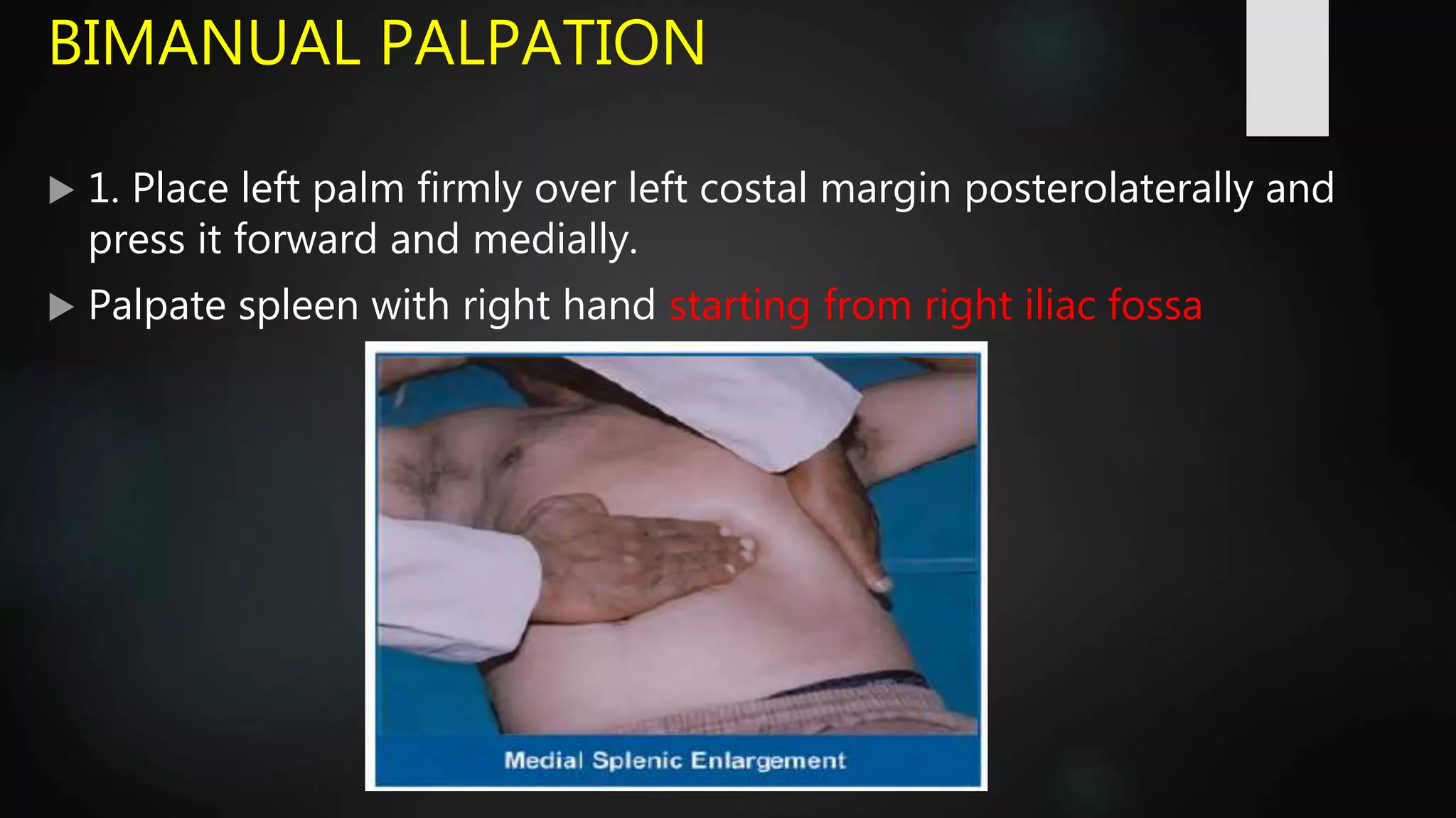 Splenomegaly Causes Clinical Approach And Examination PPTX Splenomegaly Causes Clinical Approach And Examination PPTX