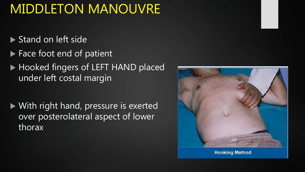 Splenomegaly causes , clinical approach and examination