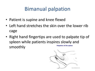 Bimanual palpation
• Patient is supine and knee flexed
• Left hand stretches the skin over the lower rib
cage
• Right hand fingertips are used to palpate tip of
spleen while patients inspires slowly and
smoothly
 